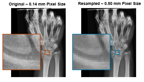 X-ray of the forearm before and after resampling to a new pixel size