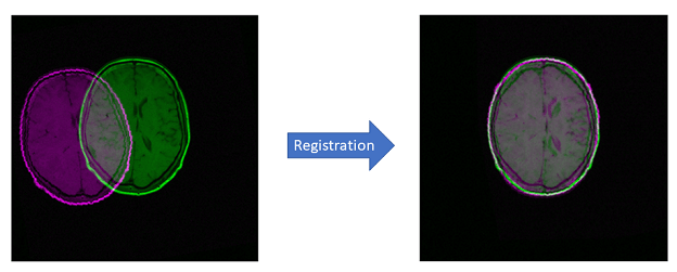 Rigid Registration