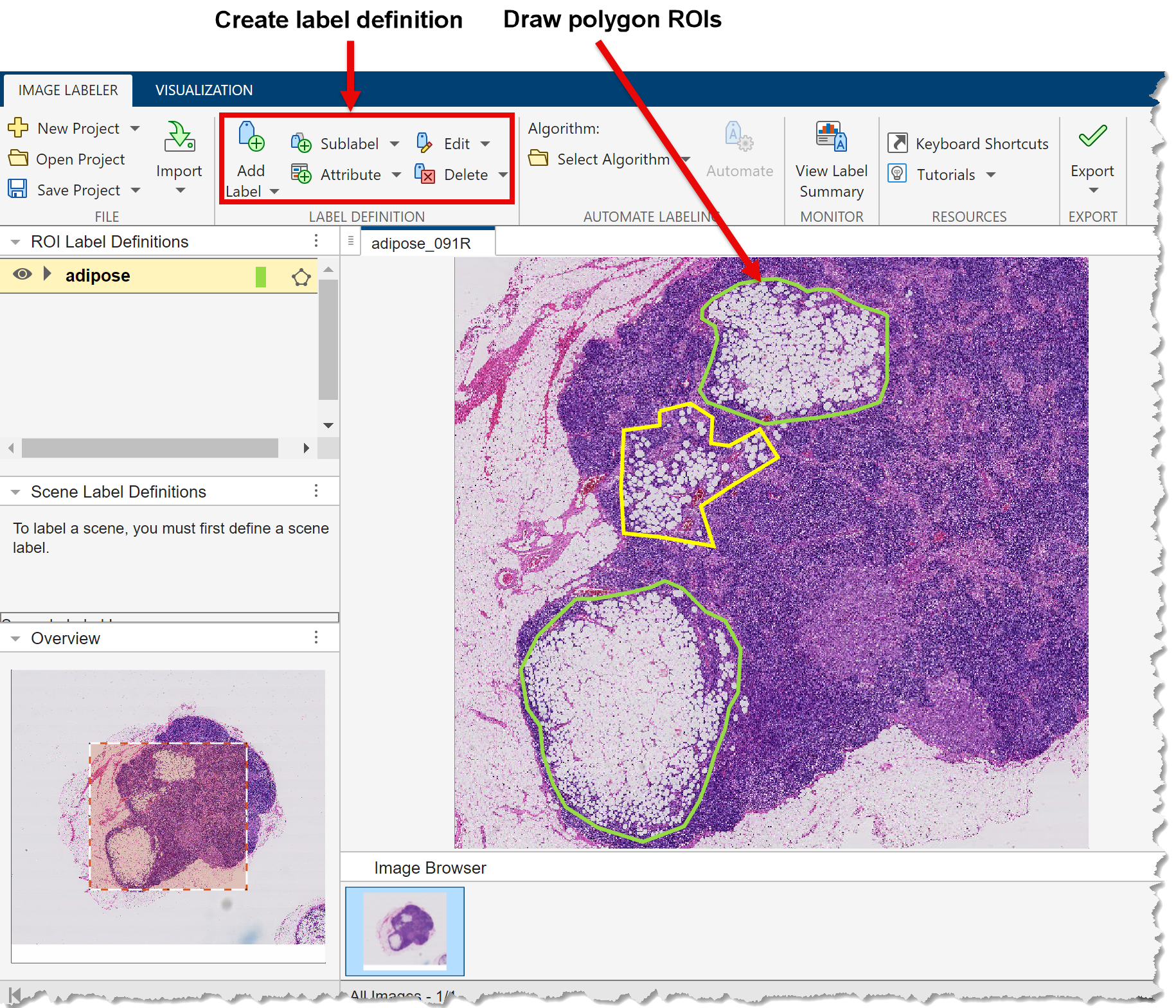 How to label a blocked image in the Image Labeler.