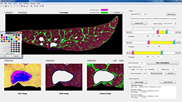 Mitsubishi Tanabe Pharma Develops Data Analysis Tools to Speed Drug Discovery