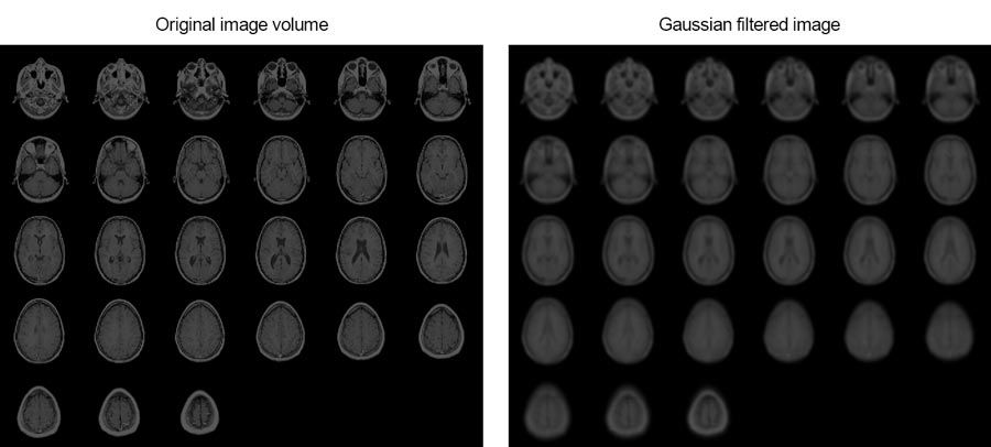 In diesem Beispiel wird gezeigt, wie Sie MRT-Bilder eines menschlichen Gehirns mithilfe einer Gauß‘schen 3D-Filterung glätten können.