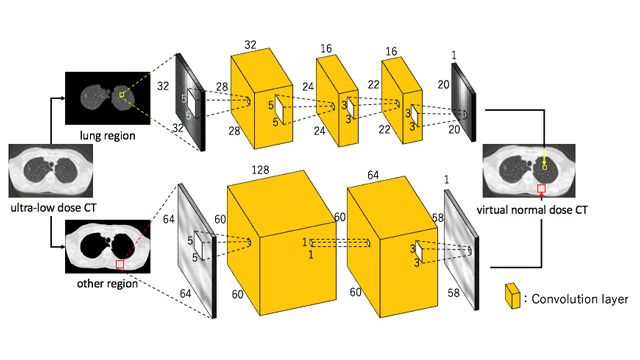 Mit Deep Learning das Strahlenbelastungsrisiko bei CT-Aufnahmen reduzieren